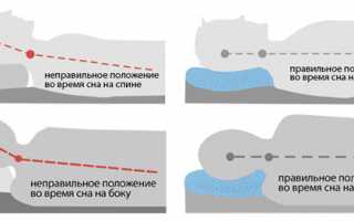 Избавляемся от болей в шее после сна