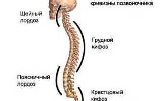 Всё о кифозе грудного отдела позвоночника