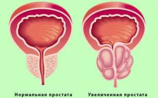 Наращивание бровей: главные методики и средства