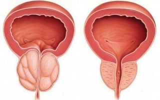 Диагностика заболеваний простаты: причины, виды, методы лечения, профилактика