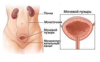 Правда ли, что у человека может лопнуть мочевой пузырь