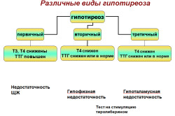 Виды гипотиреоза