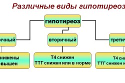 Виды гипотиреоза