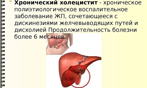 При развитии холецистита нужно более тщательно подбирать упражнения