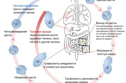 Схема заражения амебной дизентерией